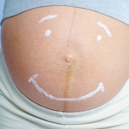 Γέννα με καισαρική τομή