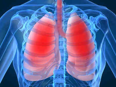 Χρόνια αναπνευστική πνευμονοπάθεια