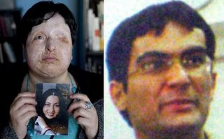 Διεθνής παρέμβαση για τη μη τύφλωση Ιρανού εγκληματία