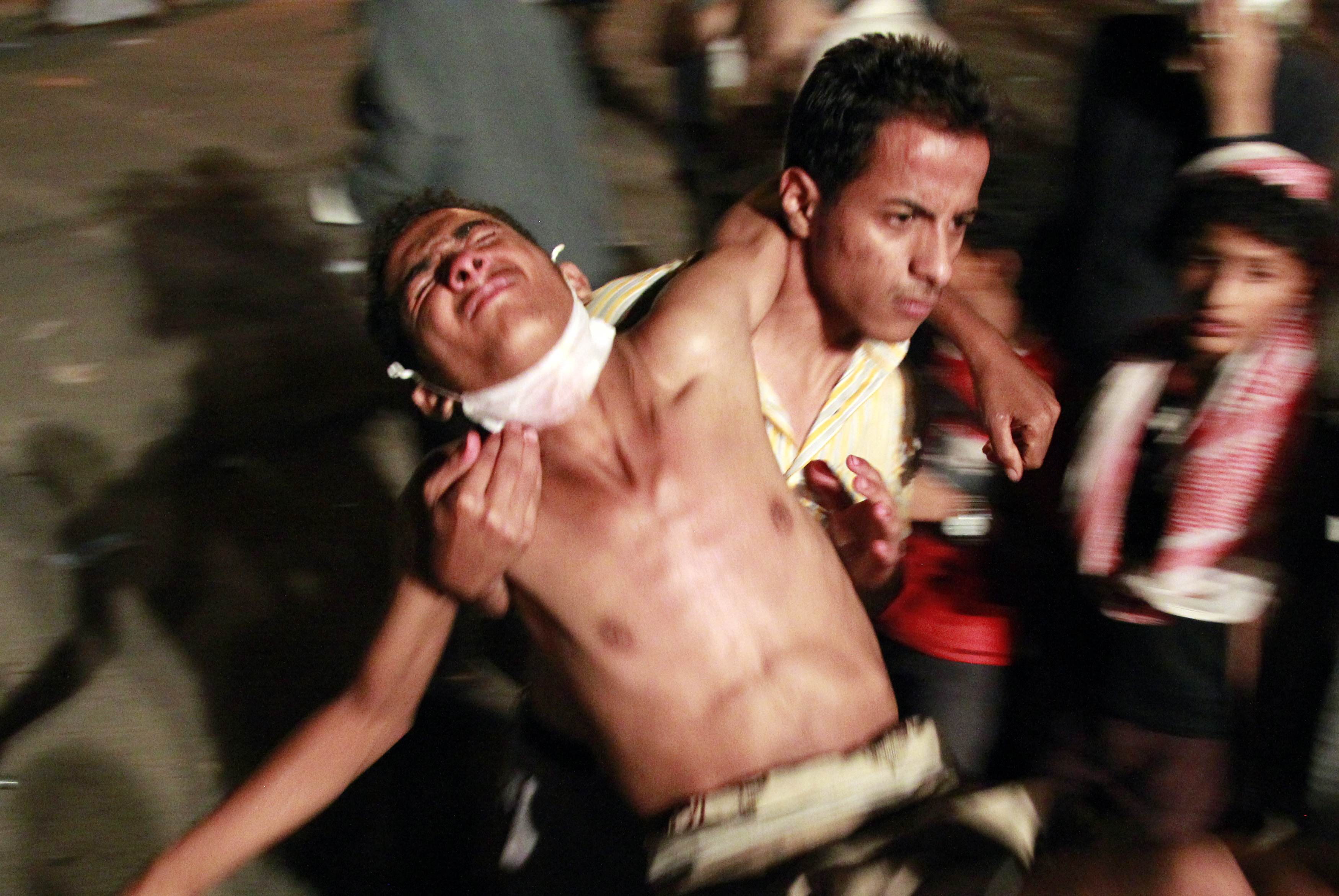 Δεκάδες οι νεκροί από τη σύγκρουση Υεμένης-Σανάα