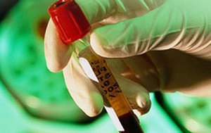 Το υπουργείο Υγείας στοχεύει στην εξάλειψη της ηπατίτιδας