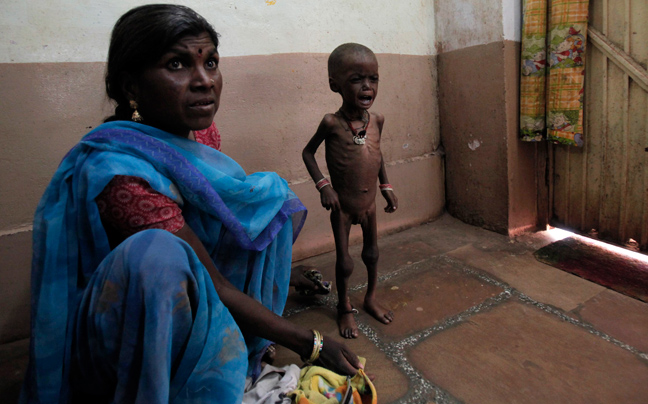 INDIA MALNUTRITION3 ΣΥΓΚΛΟΝΙΣΤΙΚΕΣ ΦΩΤΟΓΡΑΦΙΕΣ: Παιδιά ενός κατώτερου θεού...