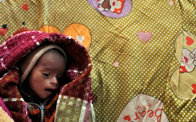 INDIA MALNUTRITION8 ΣΥΓΚΛΟΝΙΣΤΙΚΕΣ ΦΩΤΟΓΡΑΦΙΕΣ: Παιδιά ενός κατώτερου θεού...