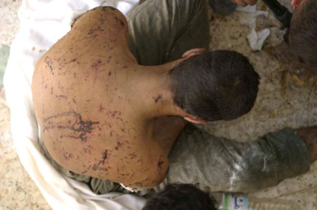 Η απόλυτη φρίκη και βασανιστήρια στη Συρία