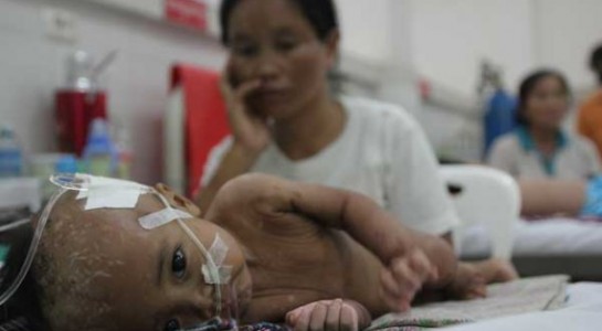 Εντεροϊός πίσω από το θάνατο 52 παιδιών στην Καμπότζη