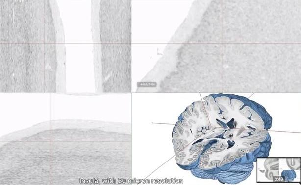 Τρισδιάστατος χάρτης του ανθρώπινου εγκεφάλου