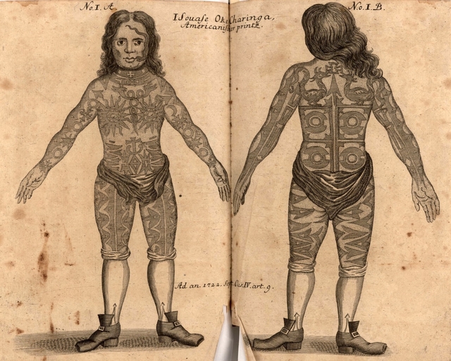 Η αιματοβαμμένη ιστορία της αφαίρεσης των τατουάζ