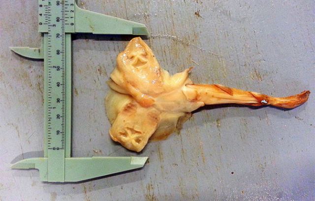 fetus.jpg