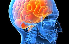 Εγκεφαλικές ανωμαλίες όσοι πάσχουν από χρόνια κόπωση