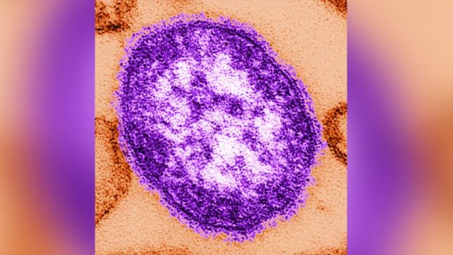 Θερίζει η επιδημία της ιλαράς στο Κονγκό