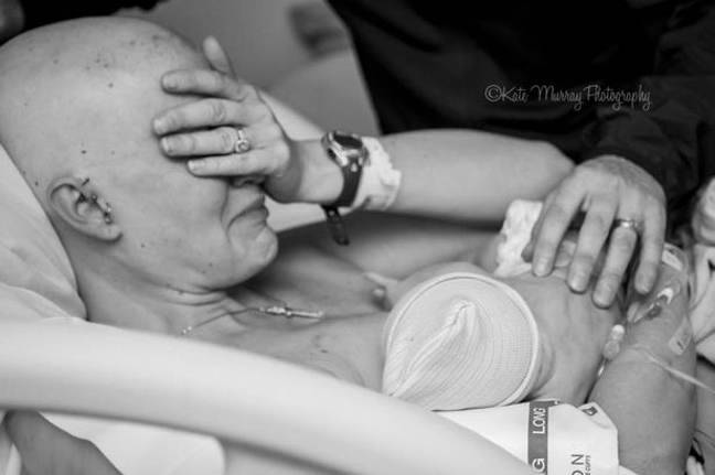 Μητέρα θηλάζει το γιο της μετά από μαστεκτομή   Υγεία