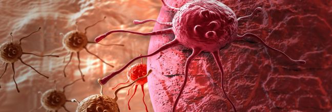 Πώς θα μπορεί να προβλέπεται μελλοντικά η μετάσταση του καρκίνου