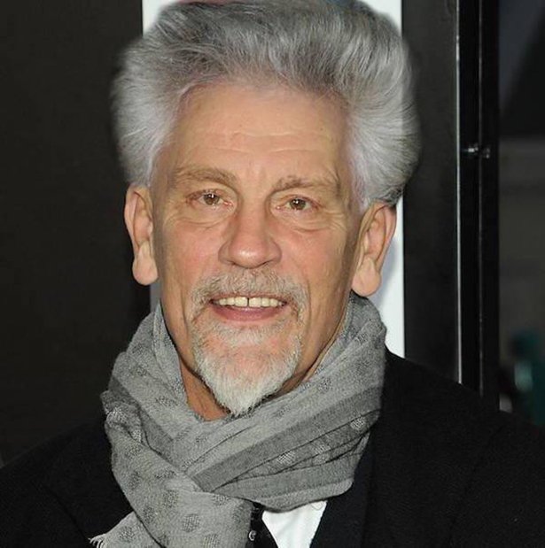 bald-celebrities-003-08052015