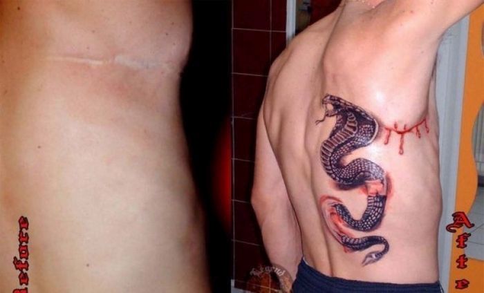 Τατουάζ που καλύπτουν ουλές