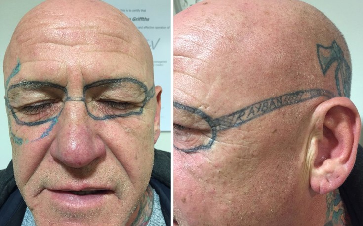 Ξύπνησε από άγριο μεθύσι και του είχαν κάνει τατουάζ στο πρόσωπο!