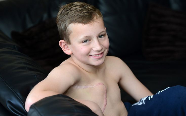 O 11χρονος που υποβλήθηκε σε μαστεκτομή