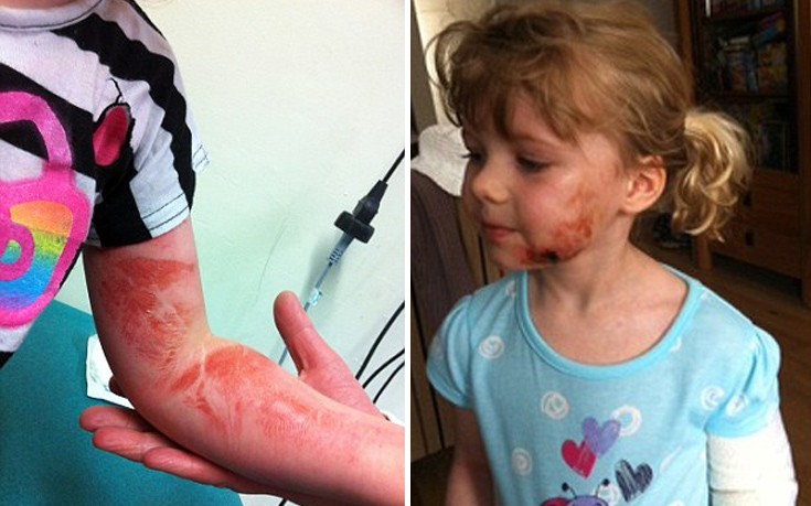 Αερόσακος χτύπησε 4χρονο κορίτσι