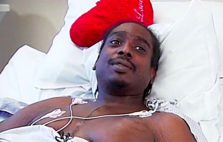 alg heart transplant jpg