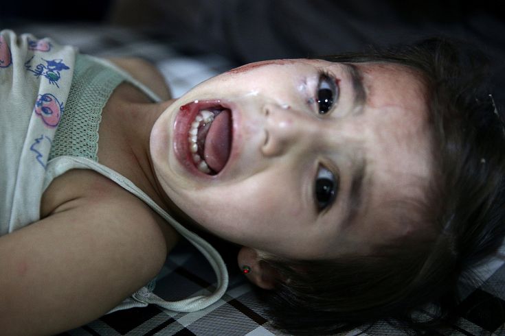 OHE: Έως και 600 τραυματίες θα πρέπει να απομακρυνθούν από το Χαλέπι