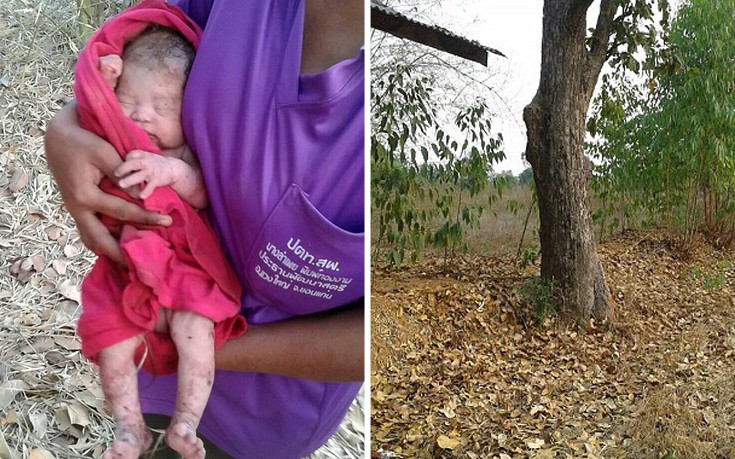 Το μωρό «θαύμα» που μαχαιρώθηκε, θάφτηκε και ξεκινά μια νέα ζωή