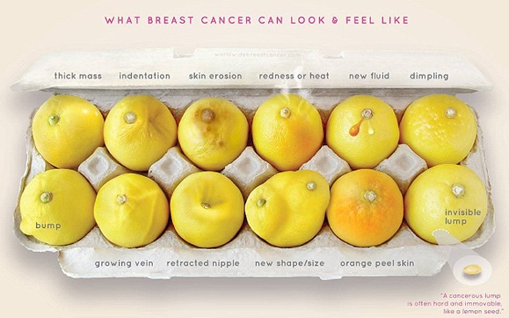 Δώδεκα συμπτώματα του καρκίνου του μαστού όπως θα φαίνονταν σε&#8230; λεμόνια
