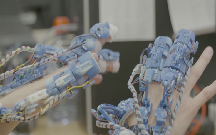Ρομποτικό σύστημα που εφαρμόζει στο χέρι στην υπηρεσία της χειρουργικής