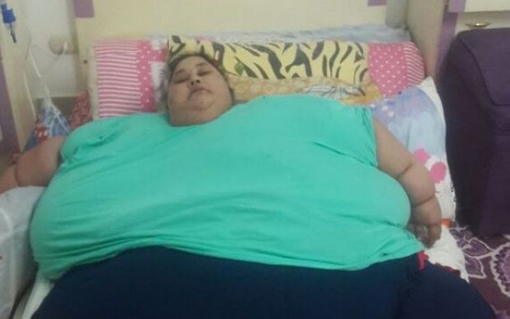 H πιο παχύσαρκη γυναίκα στον κόσμο έπεσε από τα 500 στα 400 κιλά
