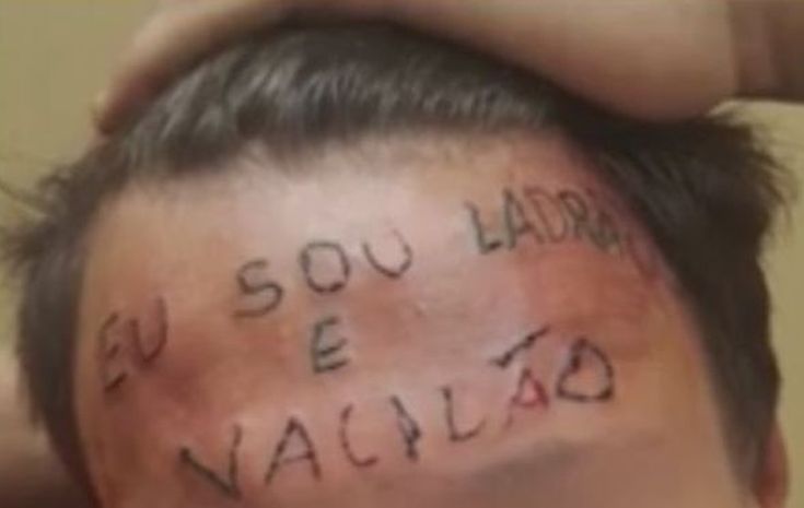 Έκαναν τατουάζ «Είμαι κλέφτης» στο μέτωπο εφήβου για να τον τιμωρήσουν