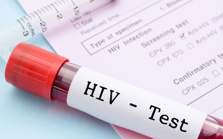 Λιγότερες νέες διαγνώσεις του ιού HIV τα τελευταία χρόνια