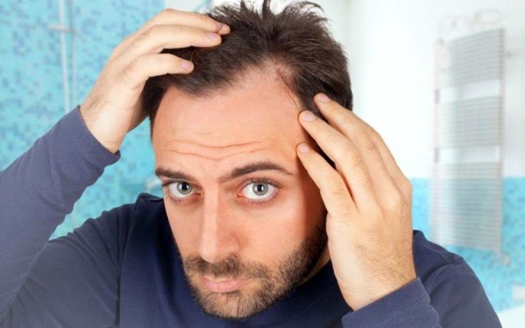 Τρεις μύθοι για την απώλεια μαλλιών που δεν ισχύουν
