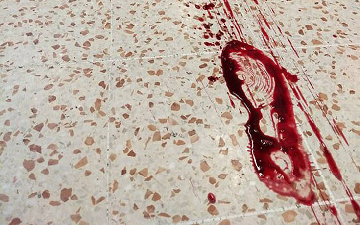 Γιατρός ακολουθεί αιματοβαμμένες πατημασιές σε εμπορικό κέντρο και ανακαλύπτει κάτι τρομακτικό