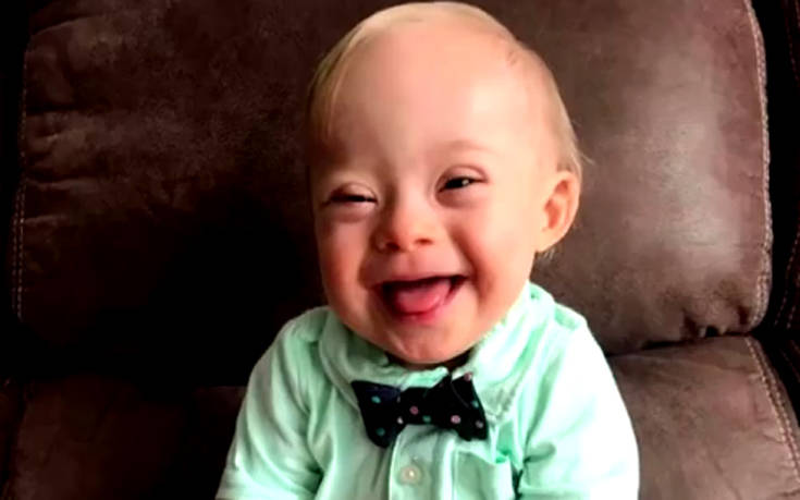 Ένα παιδάκι με σύνδρομο Down είναι το «Μωρό της Gerber» για το 2018