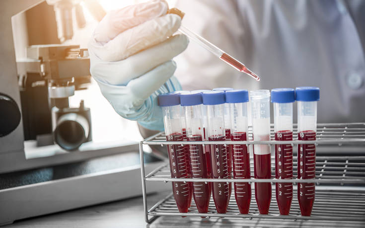 Τεστ αίματος μπορεί να προβλέψει τον καρκίνο των ωοθηκών έως και δυο χρόνια νωρίτερα