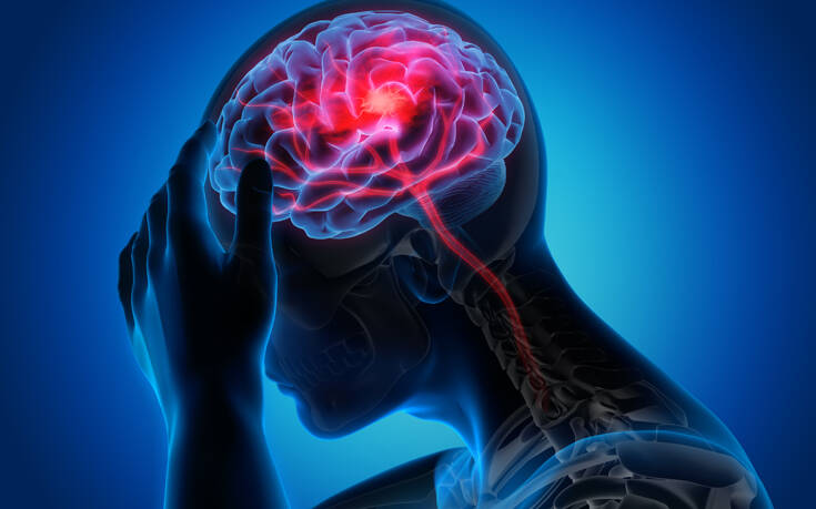 Πώς η επιληψία πλήττει τους μηχανισμούς του εγκεφάλου