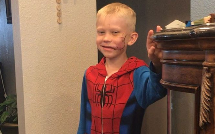 Ήρωες της Marvel αποθεώνουν τον 6χρονο που προστάτευσε την αδερφή του από επίθεση σκύλου