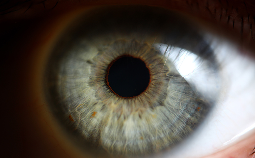 Η σοβαρή covid-19 χτυπά και τα μάτια, τι βρήκαν Γάλλοι ερευνητές