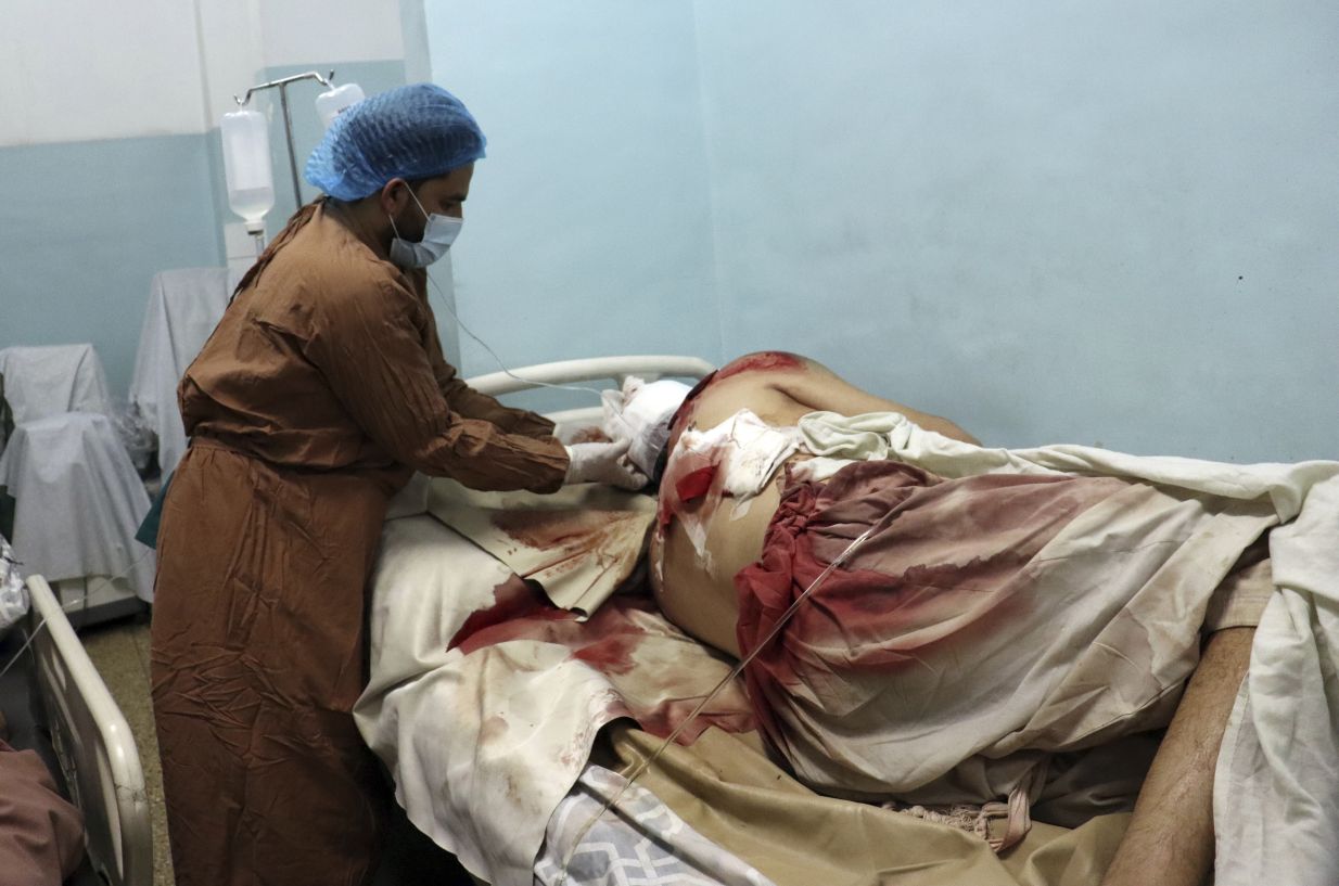 Λουτρό αίματος στην Καμπούλ: Χάος και πανικός από την διπλή επίθεση αυτοκτονίας &#8211; Πάνω από 100 οι νεκροί