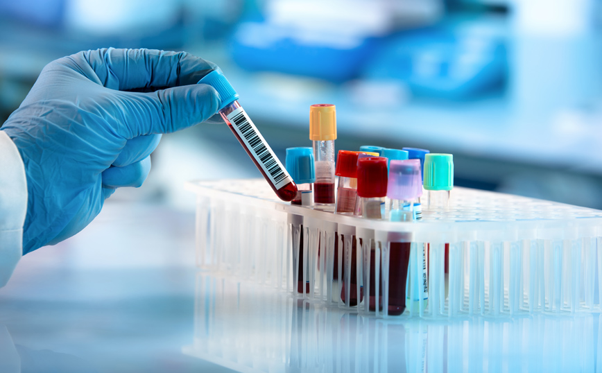 Nέο τεστ αίματος ανιχνεύει περισσότερα από 50 είδη καρκίνου πριν τα συμπτώματα &#8211; Αρχίζει η μεγαλύτερη παγκοσμίως δοκιμή