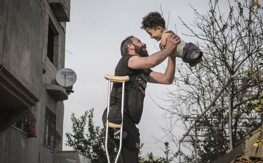 Η βραβευμένη φωτογραφία που συγκλονίζει: Ο ακρωτηριασμένος πατέρας και το παιδί χωρίς χέρια και πόδια
