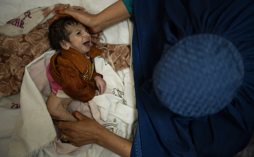 ΠΟΥ &#8211; Αφγανιστάν: Ένα εκατομμύριο παιδιά κινδυνεύουν να πεθάνουν από οξύ υποσιτισμό ως το τέλος του έτους