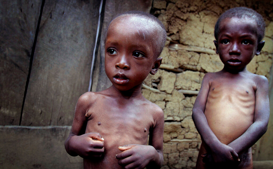 SOS από τη UNICEF: Η εκτόξευση των τιμών των τροφίμων θα οδηγήσει σε «καταστροφικά» επίπεδα τον παιδικό υποσιτισμό