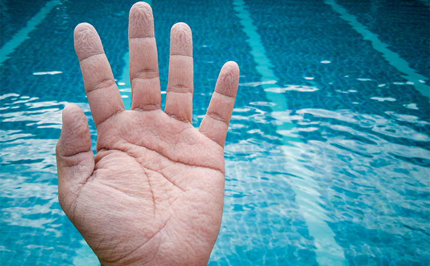 Γιατί ζαρώνουν τα δάχτυλα στο νερό &#8211; Η ανατρεπτική θεωρία που μπορεί να οδηγήσει στην πρόληψη ασθενειών