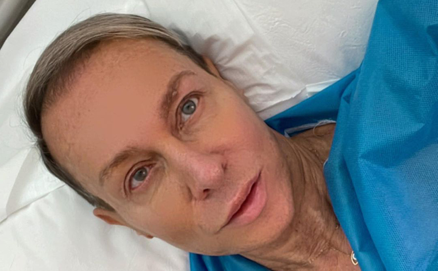 Βασίλειος Κωστέτσος: Στο νοσοκομείο ο σχεδιαστής μόδας – «Με είχαν χτυπήσει με όπλο στο μάτι»