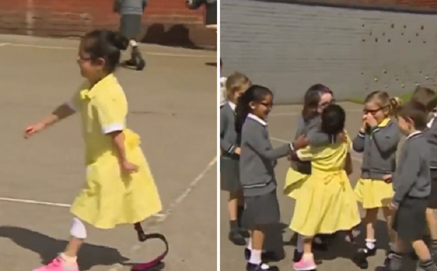 Πήγε στο σχολείο με χαρά και έδειξε το προσθετικό της πόδι &#8211; Τα παιδιά την αγκάλιασαν και έπαιξαν μαζί της