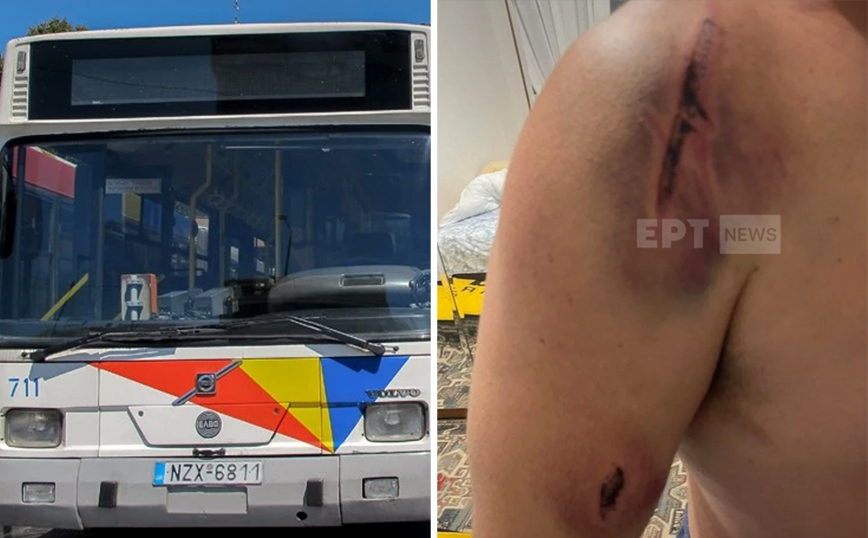 «Με χτυπούσαν στο κεφάλι και το σώμα» &#8211; Σοκάρει η εικόνα του οδηγού που έπεσε θύμα ξυλοδαρμού στη Θεσσαλονίκη