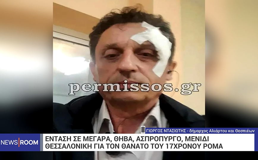 Συγκλονίζει ο δήμαρχος Αλιάρτου που χτυπήθηκε κατά τη διάρκεια επεισοδίων από Ρομά: «Θα μπορούσα να έχω χάσει το μάτι»