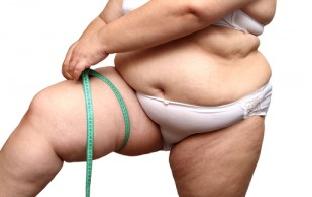 Υγιέστατο αγοράκι γέννησε γυναίκα που ζυγίζει 145 κιλά