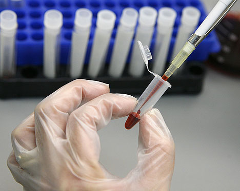 Τεστ αίματος θα επιτρέπει την εξατομικευμένη αντικαρκινική θεραπεία