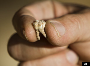 Ανακαλύφθηκε η αρχαιότερη ανθρώπινη οδοντοστοιχία