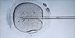 Δεν επηρεάζει το άγχος την πιθανότητα εγκυμοσύνης